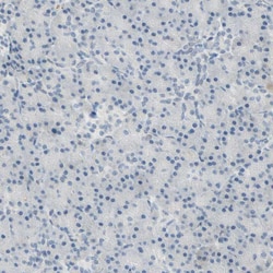Invitrogen BCL6 Polyclonal Antibody 100 &mu;L; Unconjugated:Antibodies,