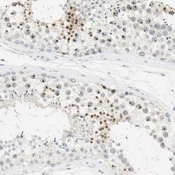 Invitrogen BCL6 Polyclonal Antibody 100 &mu;L; Unconjugated:Antibodies,