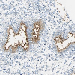 Invitrogen CD133 Polyclonal Antibody 100 &mu;L; Unconjugated:Antibodies,