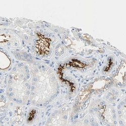Invitrogen CD133 Polyclonal Antibody 100 &mu;L; Unconjugated:Antibodies,