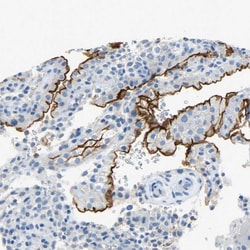 Invitrogen CD133 Polyclonal Antibody 100 &mu;L; Unconjugated:Antibodies,