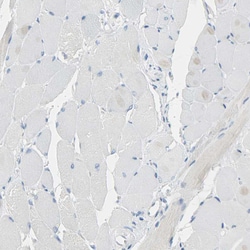 Invitrogen CD133 Polyclonal Antibody 100 &mu;L; Unconjugated:Antibodies,