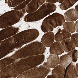 BIN1 Polyclonal Antibody:Antibodies, Polyclonal