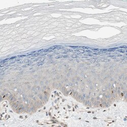 BIN1 Polyclonal Antibody:Antibodies, Polyclonal
