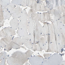 Invitrogen HRD1 Polyclonal Antibody 100 &mu;L; Unconjugated:Antibodies,