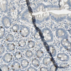 Invitrogen TPX2 Polyclonal Antibody 100 &mu;L; Unconjugated:Antibodies,