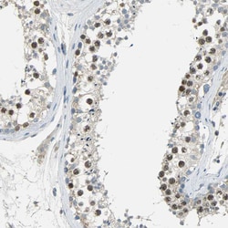 Invitrogen TPX2 Polyclonal Antibody 100 &mu;L; Unconjugated:Antibodies,