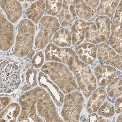 cIAP1 Polyclonal Antibody:Antibodies, Polyclonal