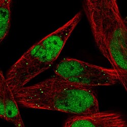 Invitrogen MEF2C Polyclonal Antibody 100 &mu;L; Unconjugated:Antibodies,