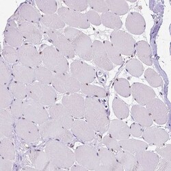 Invitrogen MEF2C Polyclonal Antibody 100 &mu;L; Unconjugated:Antibodies,