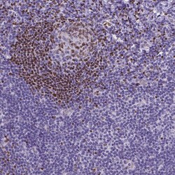 Invitrogen MEF2C Polyclonal Antibody 100 &mu;L; Unconjugated:Antibodies,