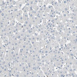 Invitrogen DLG7 Polyclonal Antibody 100 &mu;L | Buy Online | Invitrogen&trade; | Fisher Scientific