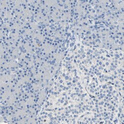 Invitrogen DLG7 Polyclonal Antibody 100 &mu;L | Buy Online | Invitrogen&trade; | Fisher Scientific