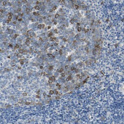 Invitrogen DLG7 Polyclonal Antibody 100 &mu;L | Buy Online | Invitrogen&trade; | Fisher Scientific