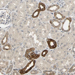 Invitrogen ACSL4 Polyclonal Antibody 100 &mu;L; Unconjugated:Antibodies,