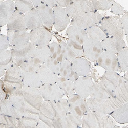 Invitrogen ACSL4 Polyclonal Antibody 100 &mu;L; Unconjugated:Antibodies,