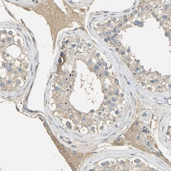 Invitrogen ACSL4 Polyclonal Antibody 100 &mu;L; Unconjugated:Antibodies,