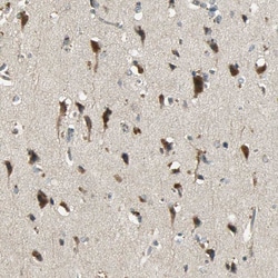 Invitrogen KEAP1 Polyclonal Antibody 100 &mu;L; Unconjugated:Antibodies,