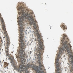 Invitrogen KEAP1 Polyclonal Antibody 100 &mu;L; Unconjugated:Antibodies,