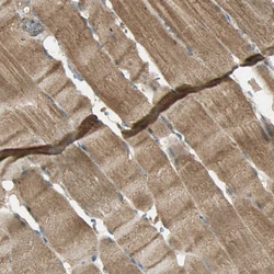 Invitrogen KEAP1 Polyclonal Antibody 100 &mu;L; Unconjugated:Antibodies,