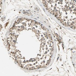 Invitrogen KEAP1 Polyclonal Antibody 100 &mu;L; Unconjugated:Antibodies,