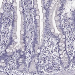 GCAP1 Polyclonal Antibody:Antibodies, Polyclonal