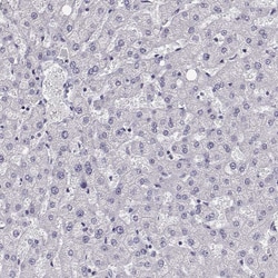GCAP1 Polyclonal Antibody:Antibodies, Polyclonal