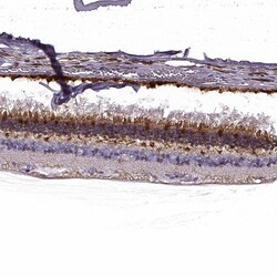 GCAP1 Polyclonal Antibody:Antibodies, Polyclonal