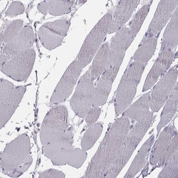 GCAP1 Polyclonal Antibody:Antibodies, Polyclonal