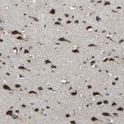 Invitrogen NSD3 Polyclonal Antibody 100 &mu;L; Unconjugated:Antibodies,