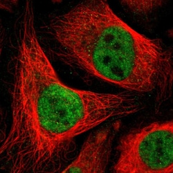 Invitrogen DLX5 Polyclonal Antibody 100 &mu;L; Unconjugated:Antibodies,