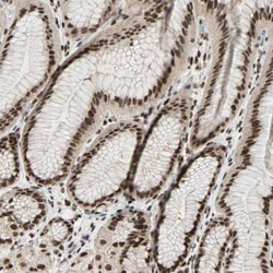 Invitrogen Blooms Syndrome Polyclonal Antibody 100 &mu;L; Unconjugated:Antibodies,
