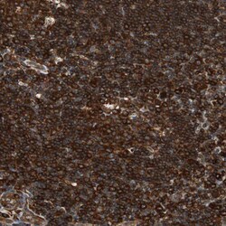 Invitrogen VASP Polyclonal Antibody 100 &mu;L; Unconjugated:Antibodies,