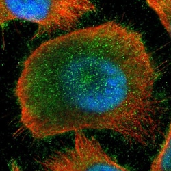 Kaiso Polyclonal Antibody:Antibodies, Polyclonal