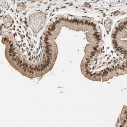 Kaiso Polyclonal Antibody:Antibodies, Polyclonal