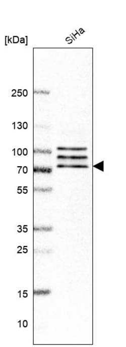 Invitrogen CNOT4 Polyclonal Antibody 100 &mu;L | Buy Online | Invitrogen&trade; | Fisher Scientific