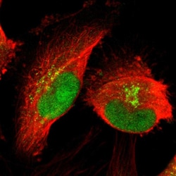 Invitrogen PRDM2 Polyclonal Antibody 100 &mu;L; Unconjugated:Antibodies,