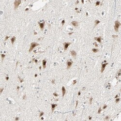 Invitrogen PRDM2 Polyclonal Antibody 100 &mu;L; Unconjugated:Antibodies,