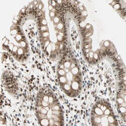 Invitrogen PRDM2 Polyclonal Antibody 100 &mu;L; Unconjugated:Antibodies,