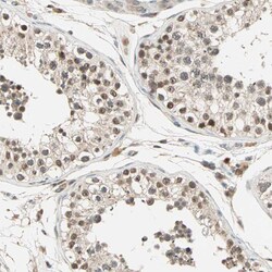 Invitrogen PRDM2 Polyclonal Antibody 100 &mu;L; Unconjugated:Antibodies,