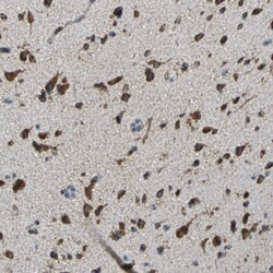 Invitrogen ECH1 Polyclonal Antibody 100 &mu;L; Unconjugated:Antibodies,