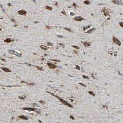 Invitrogen ECH1 Polyclonal Antibody 100 &mu;L; Unconjugated:Antibodies,