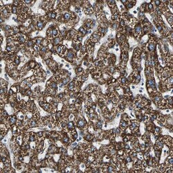 Invitrogen ECH1 Polyclonal Antibody 100 &mu;L; Unconjugated:Antibodies,