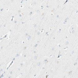 PR3 Polyclonal Antibody, Invitrogen 100 &mu;L; Unconjugated:Antibodies,