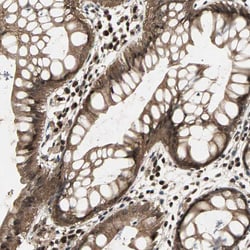 Invitrogen CK2 beta Polyclonal Antibody 100 &mu;L; Unconjugated:Antibodies,