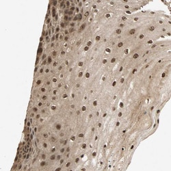 Invitrogen CK2 beta Polyclonal Antibody 100 &mu;L; Unconjugated:Antibodies,