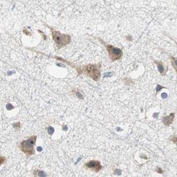 Invitrogen TCP-1 epsilon Polyclonal Antibody 100 &mu;L; Unconjugated:Antibodies,