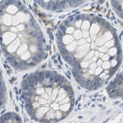 Invitrogen TCP-1 epsilon Polyclonal Antibody 100 &mu;L; Unconjugated:Antibodies,