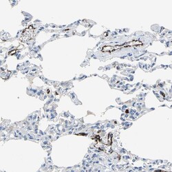 Invitrogen P-Selectin Polyclonal Antibody 100 &mu;L; Unconjugated:Antibodies,