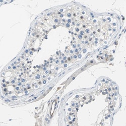Invitrogen P-Selectin Polyclonal Antibody 100 &mu;L; Unconjugated:Antibodies,